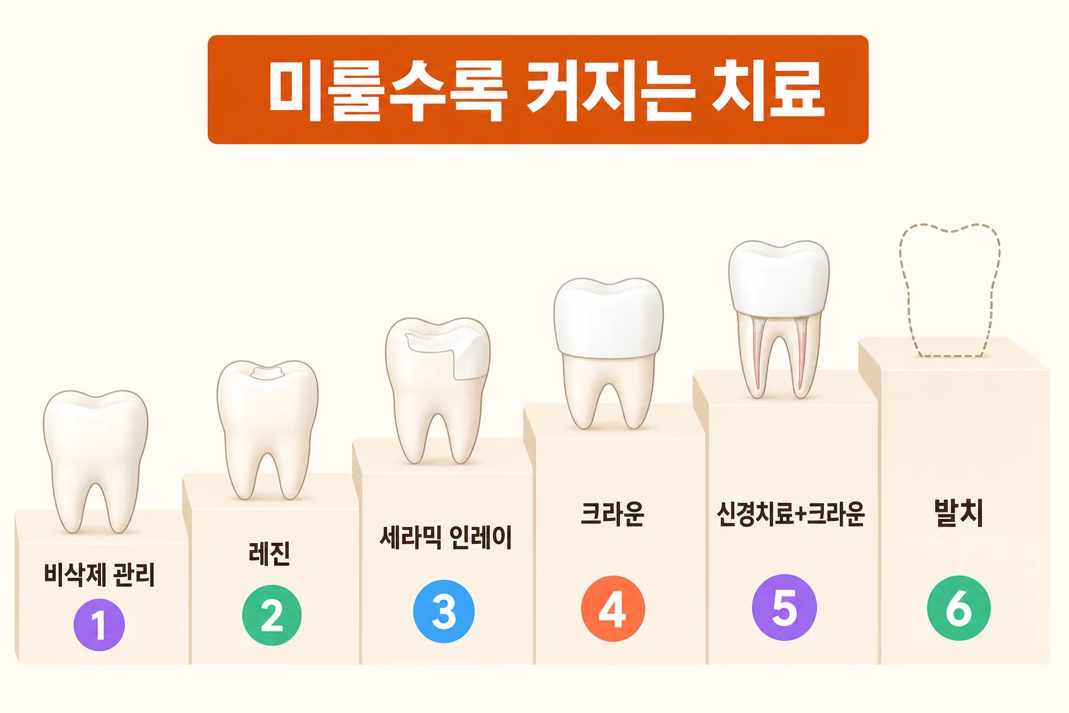 초기 충치의 비삭제 관리부터 레진, 세라믹 인레이, 크라운, 신경치료, 발치까지 단계가 올라갈수록 치료 범위가 커지는 순서를 나타낸 인포그래픽