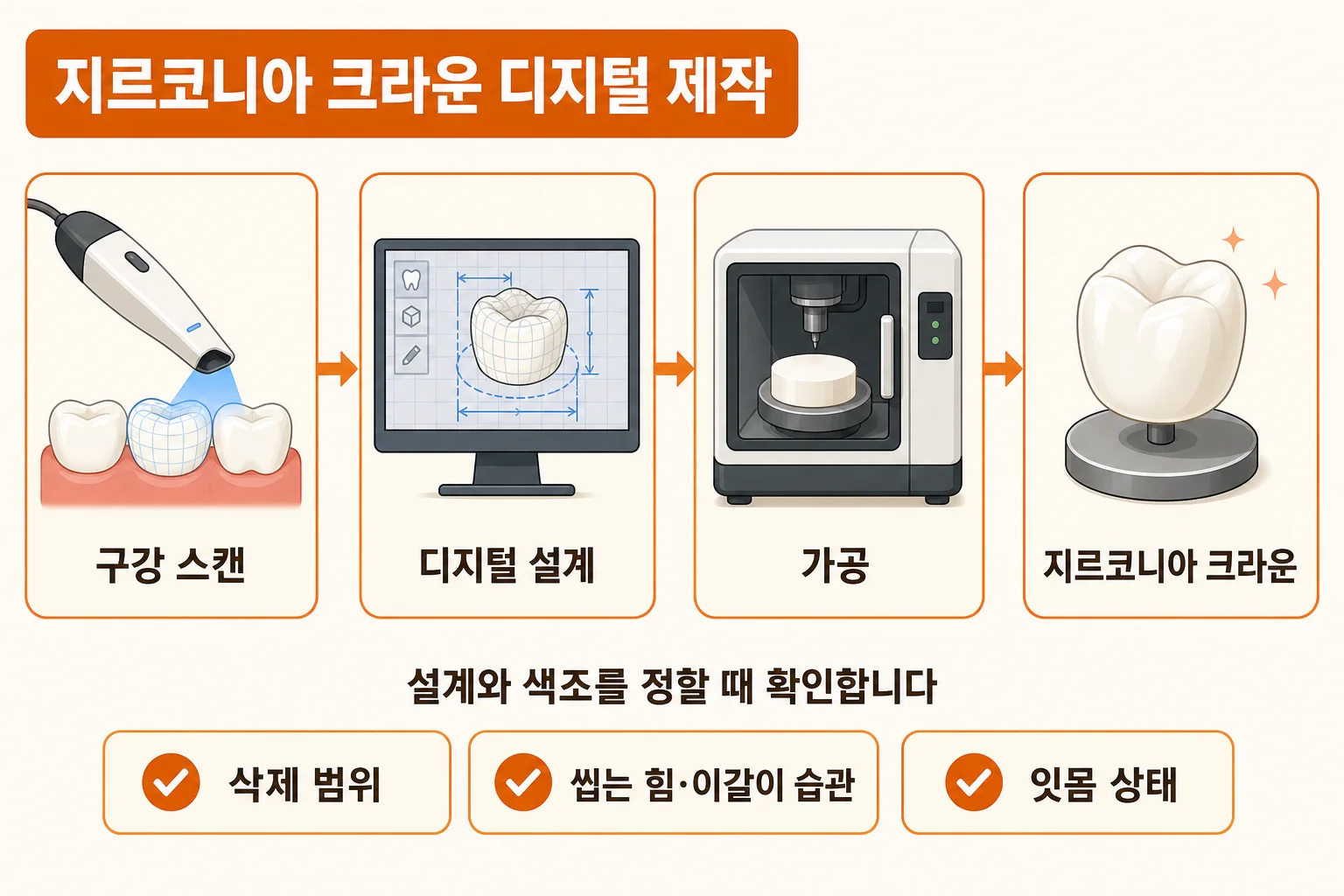 지르코니아 크라운을 구강 스캔과 디지털 설계, 가공을 거쳐 제작하는 네 단계와 설계 시 확인 항목을 정리한 인포그래픽