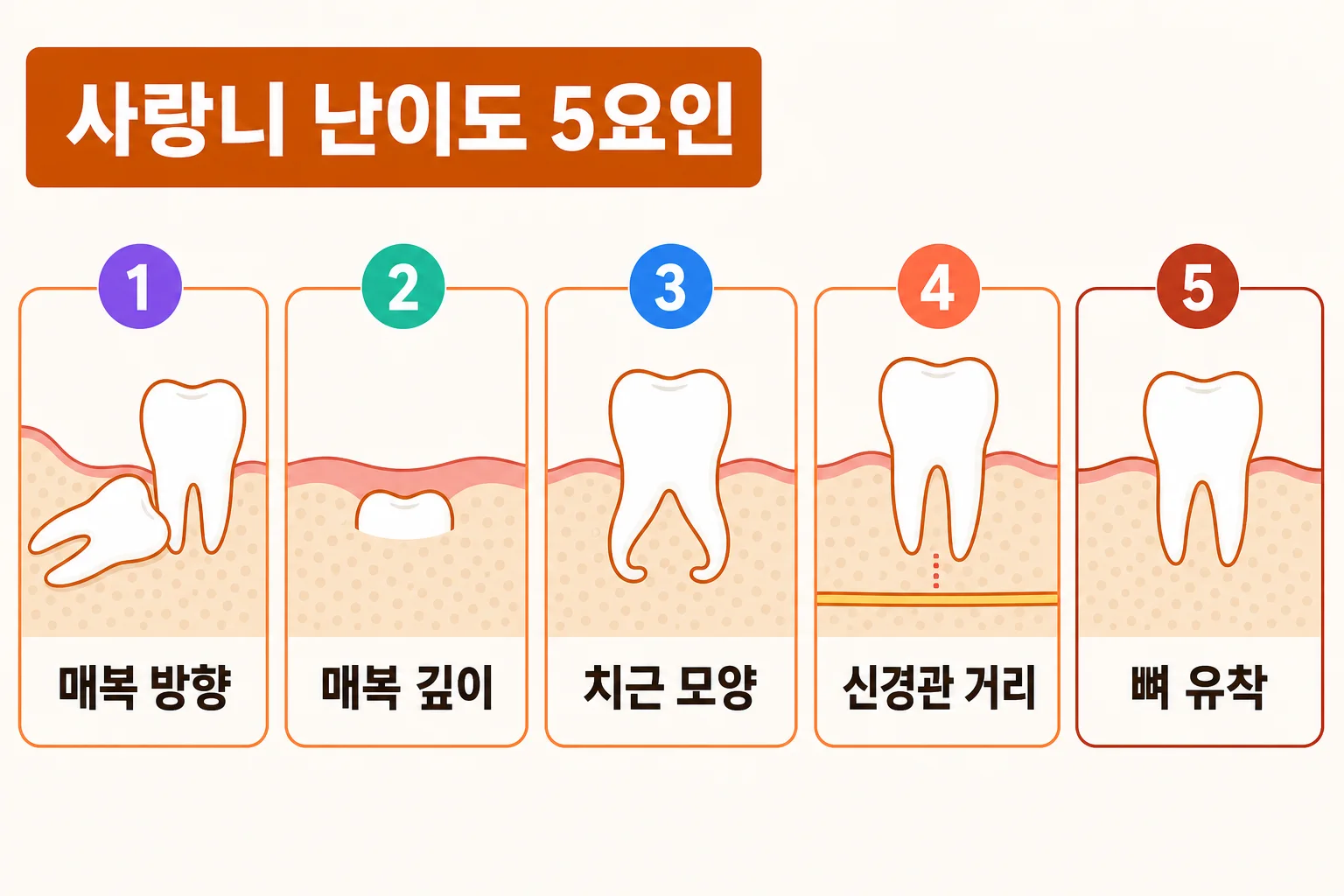 내 사랑니는 왜 유독 어렵다고 할까 | 사랑니 매복 난이도가 갈리는 기준 | 파주 서울이고운치과 내용을 설명하는 치과 진료 이미지