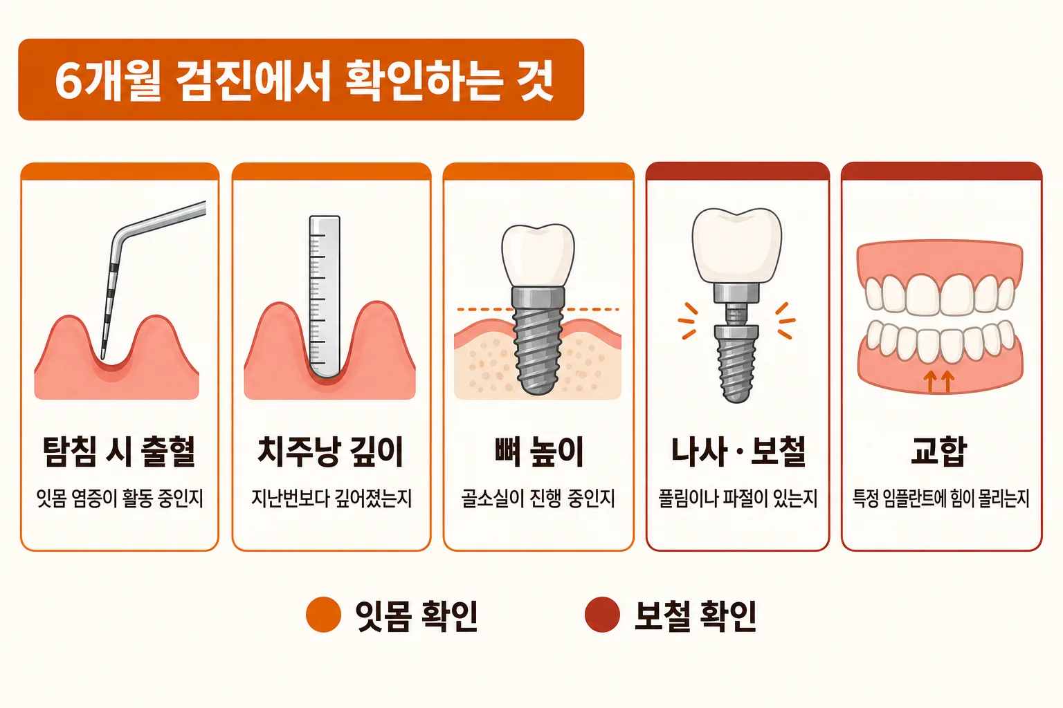 임플란트 6개월 검진에서 확인하는 탐침 출혈, 치주낭 깊이, 뼈 높이, 나사와 보철, 교합 항목을 정리한 체크리스트 인포그래픽