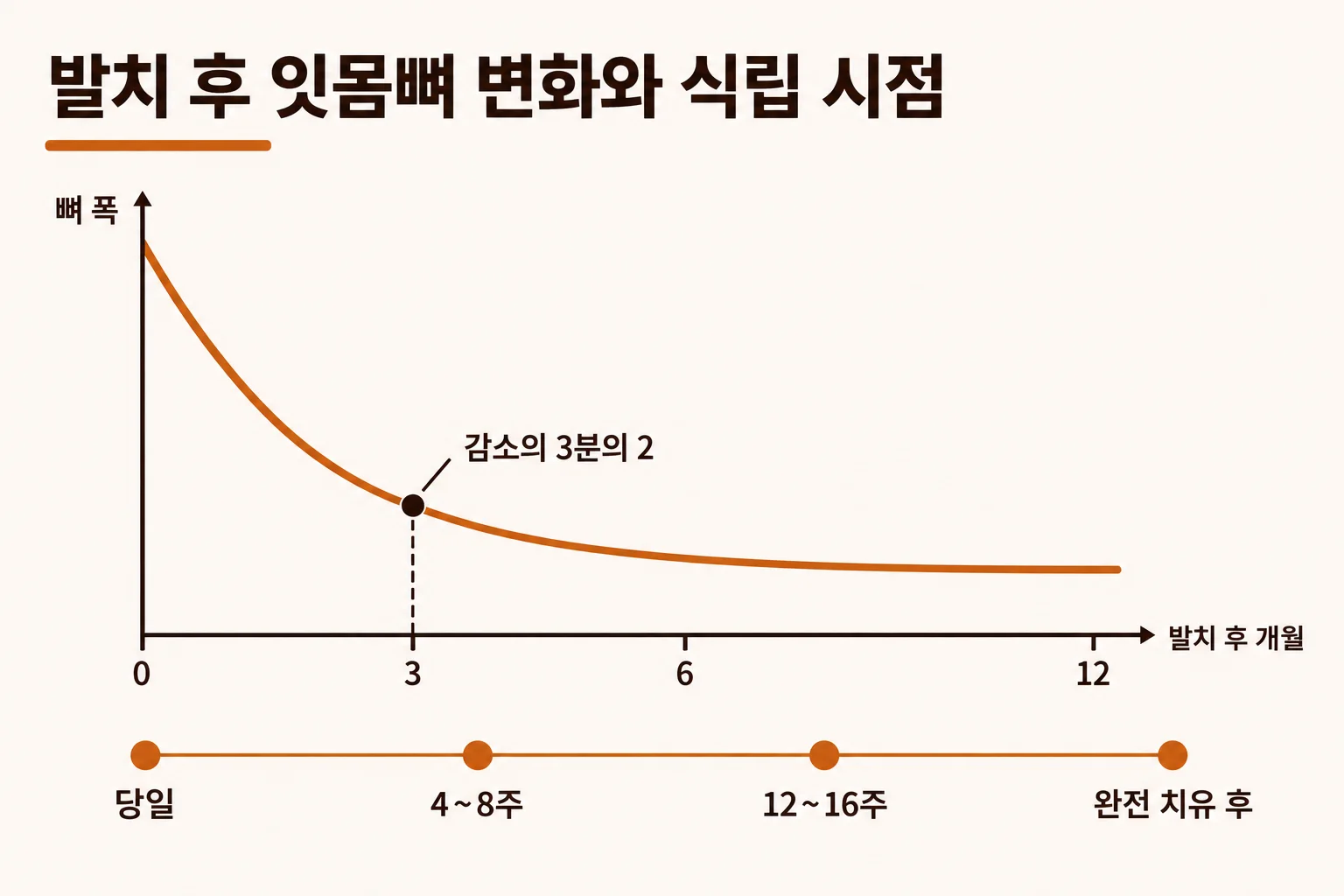 발치 후 12개월 동안 잇몸뼈 폭이 줄어드는 곡선 위에 당일, 4~8주, 12~16주, 완전 치유 후 네 식립 시점을 표시한 인포그래픽