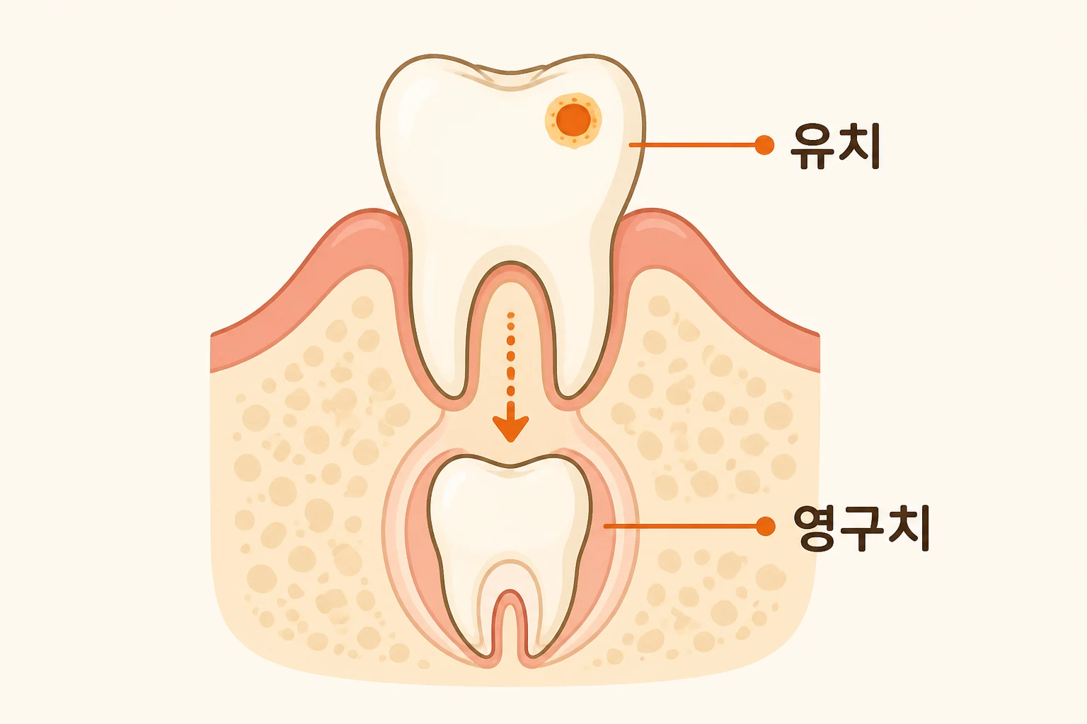 유치 충치도 치료해야 하나요? 영구치 자리와 씹기까지 보는 기준 | 파주 서울이고운치과 내용을 설명하는 치과 진료 이미지