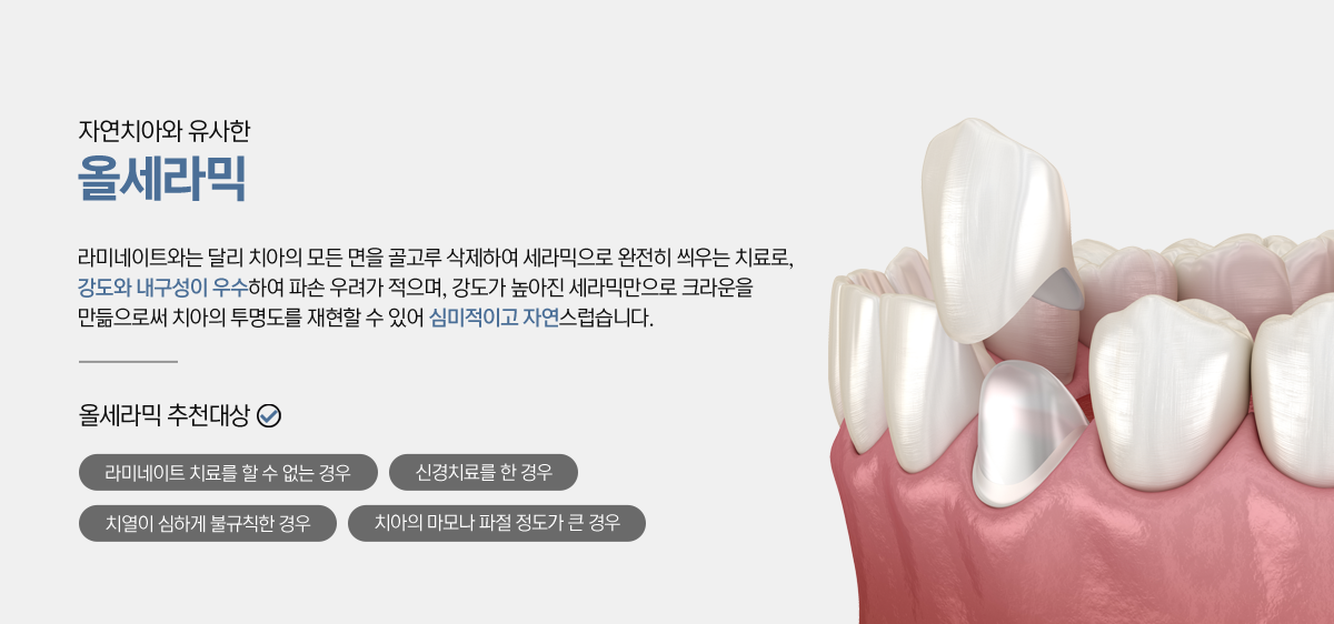 ��ġ�ϸ� ������ ġ���뵵 �������� ��ġ!
�ʱ� ��ġ�� ������ �������� �ʾ� ������ ġ��ñ⸦ ��ġ�� �����ϴ�.
��������� ���� �� ġ�ƻ��¸� üũ�ؾ� �մϴ�.